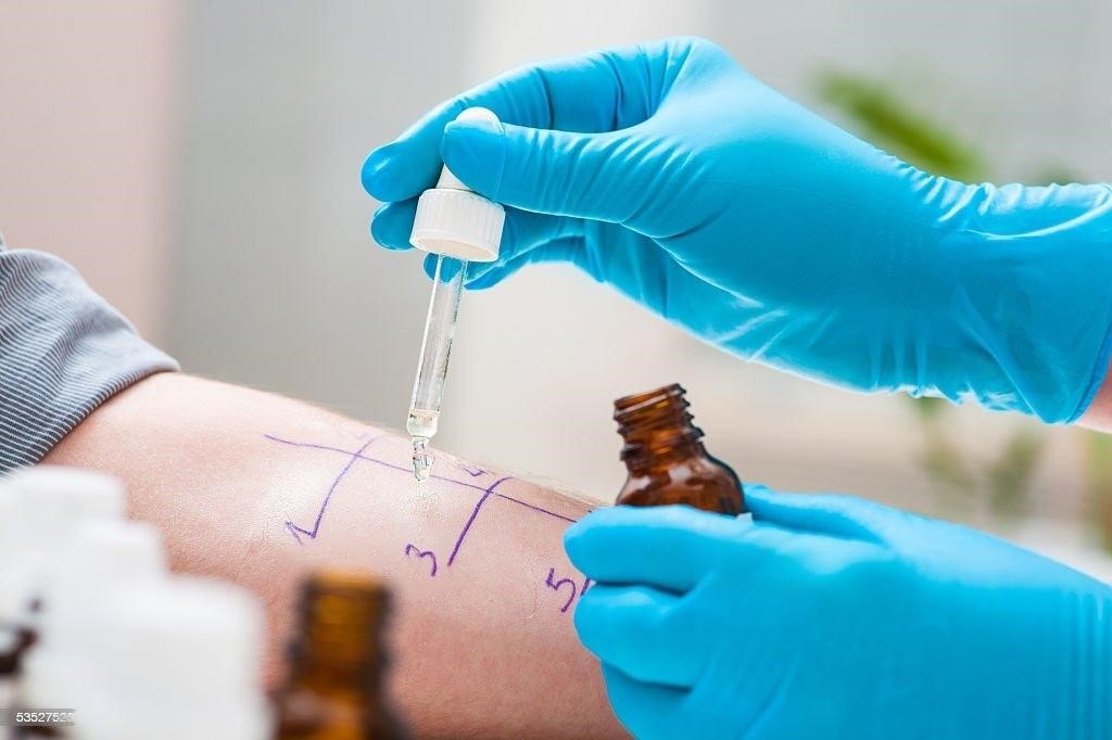 Can You Be Allergic to Marijuana? Signs & Symptoms